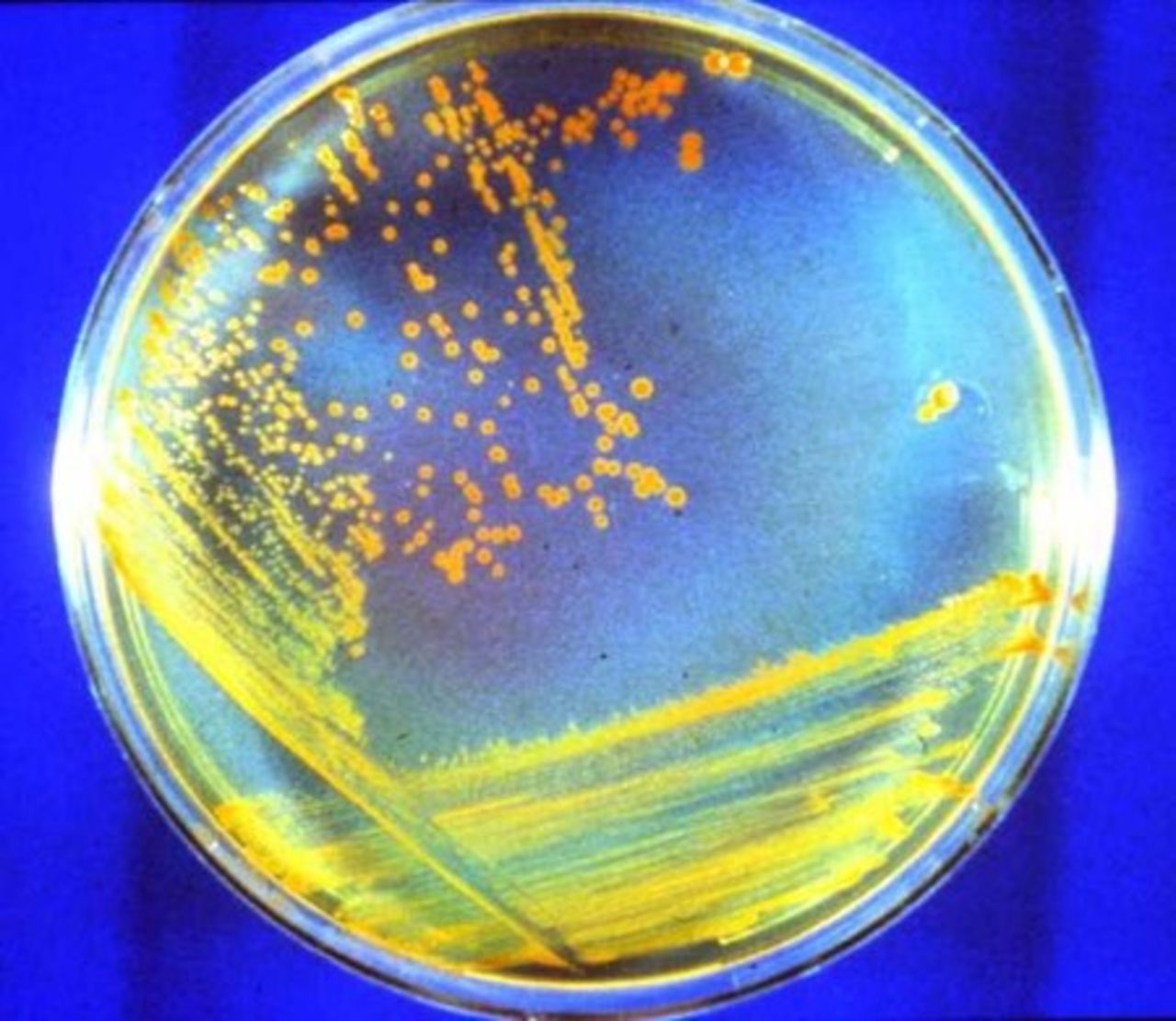Capsula di Petri con il batterio Deinococcus radiodurans