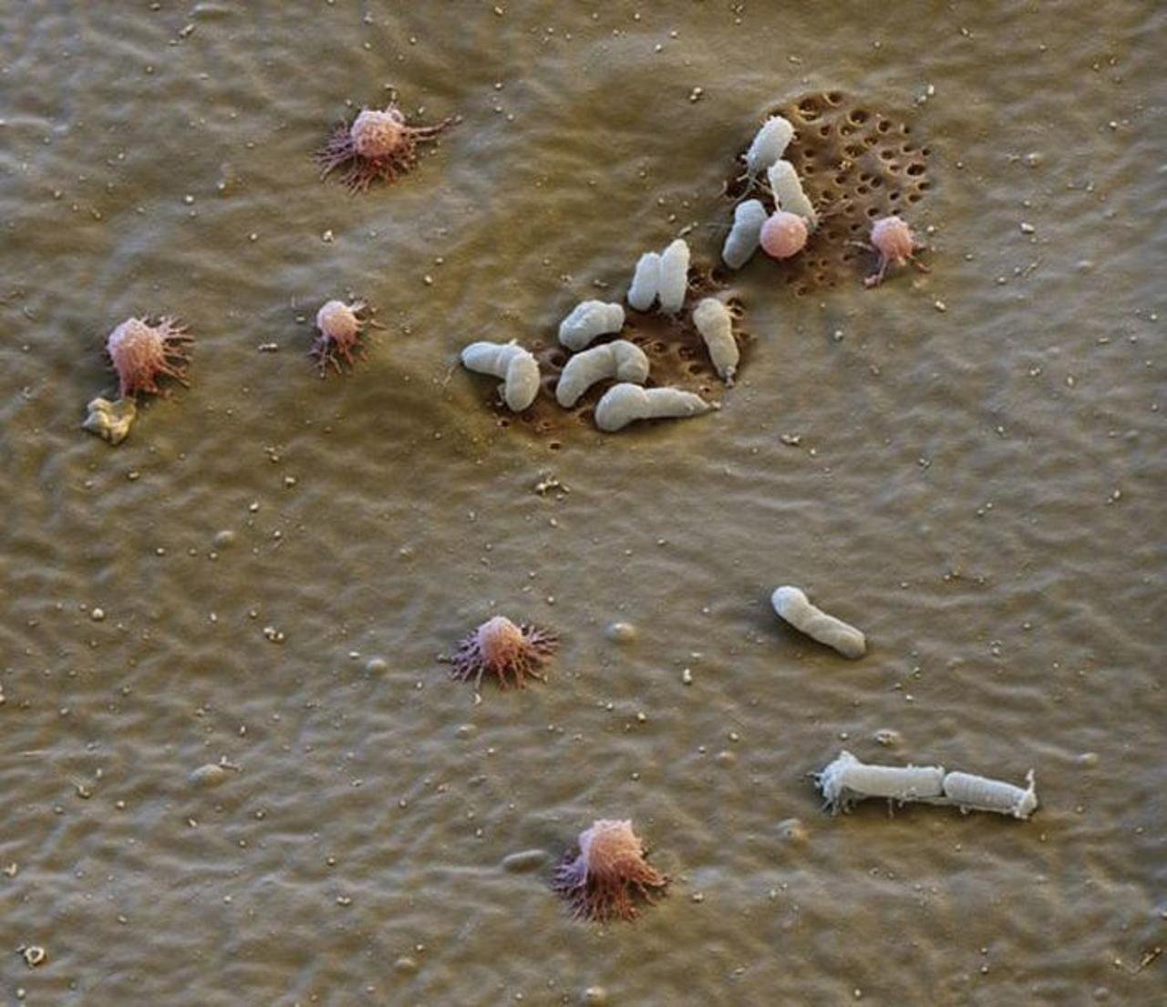 Colonia tardigrado